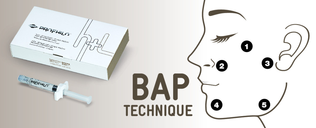 Inovativni preparat za mezoterapijo